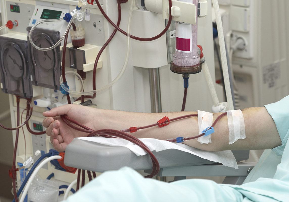 Hemodialysis