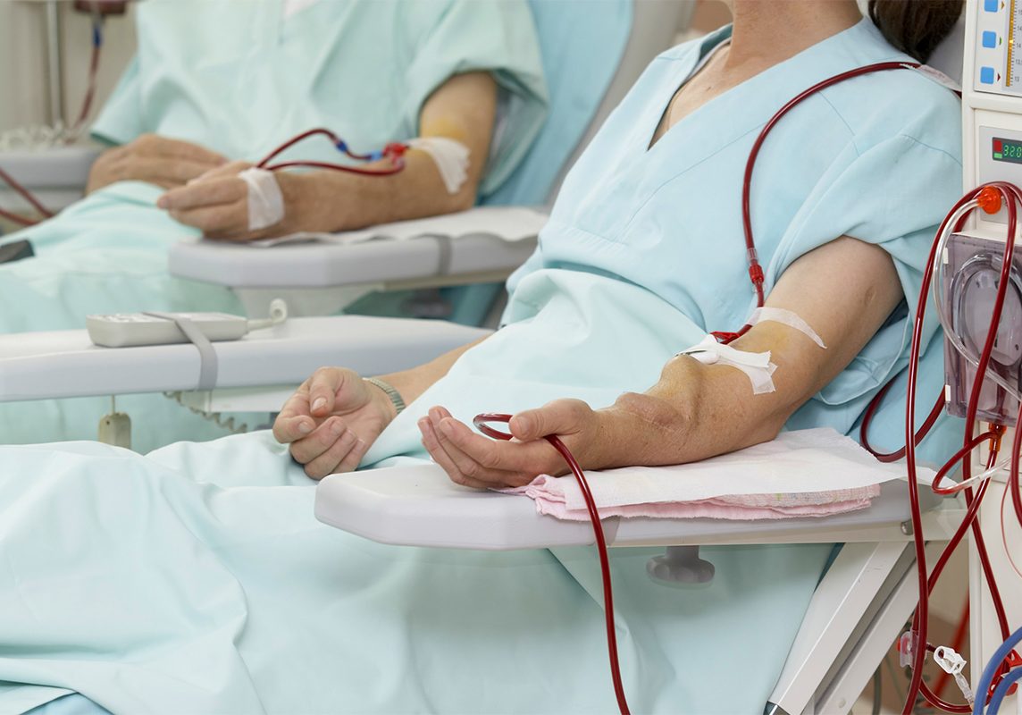 Kidney-Transplant-Managment