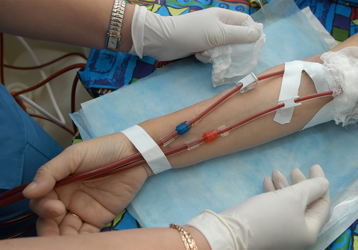 dialysis-img